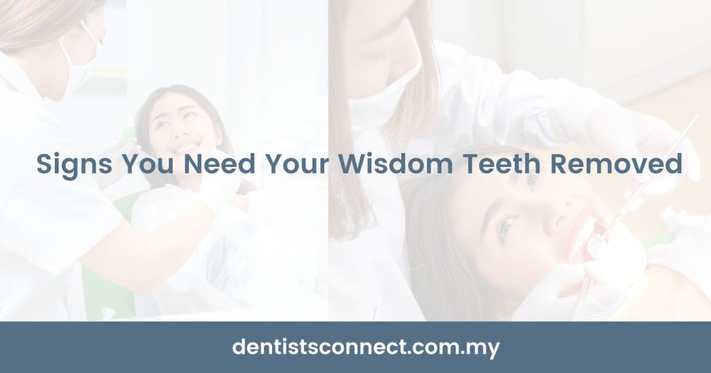Signs You Need Your Wisdom Teeth Removed