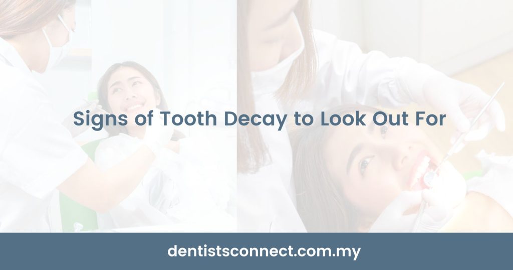 Signs of Tooth Decay to Look Out For