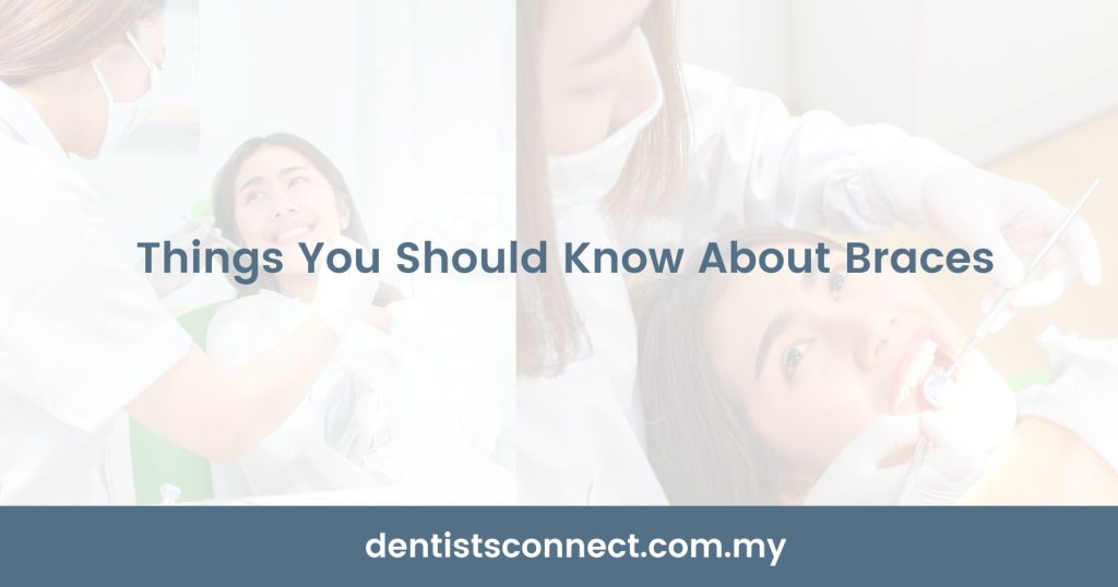 Things You Should Know About Braces